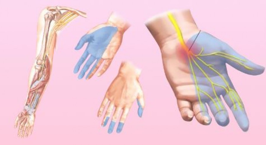 Az ujjaid zsibbadása az egészségi állapotodra utal  